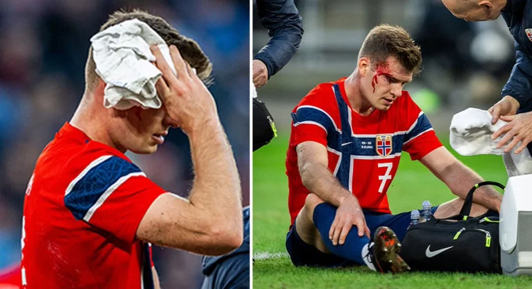 Sorloth da el susto con Noruega y pide el cambio por un fuerte golpe en la cabeza